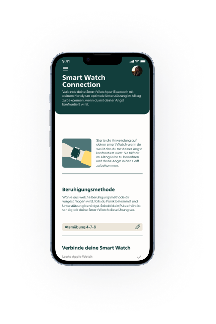 SmartWatch